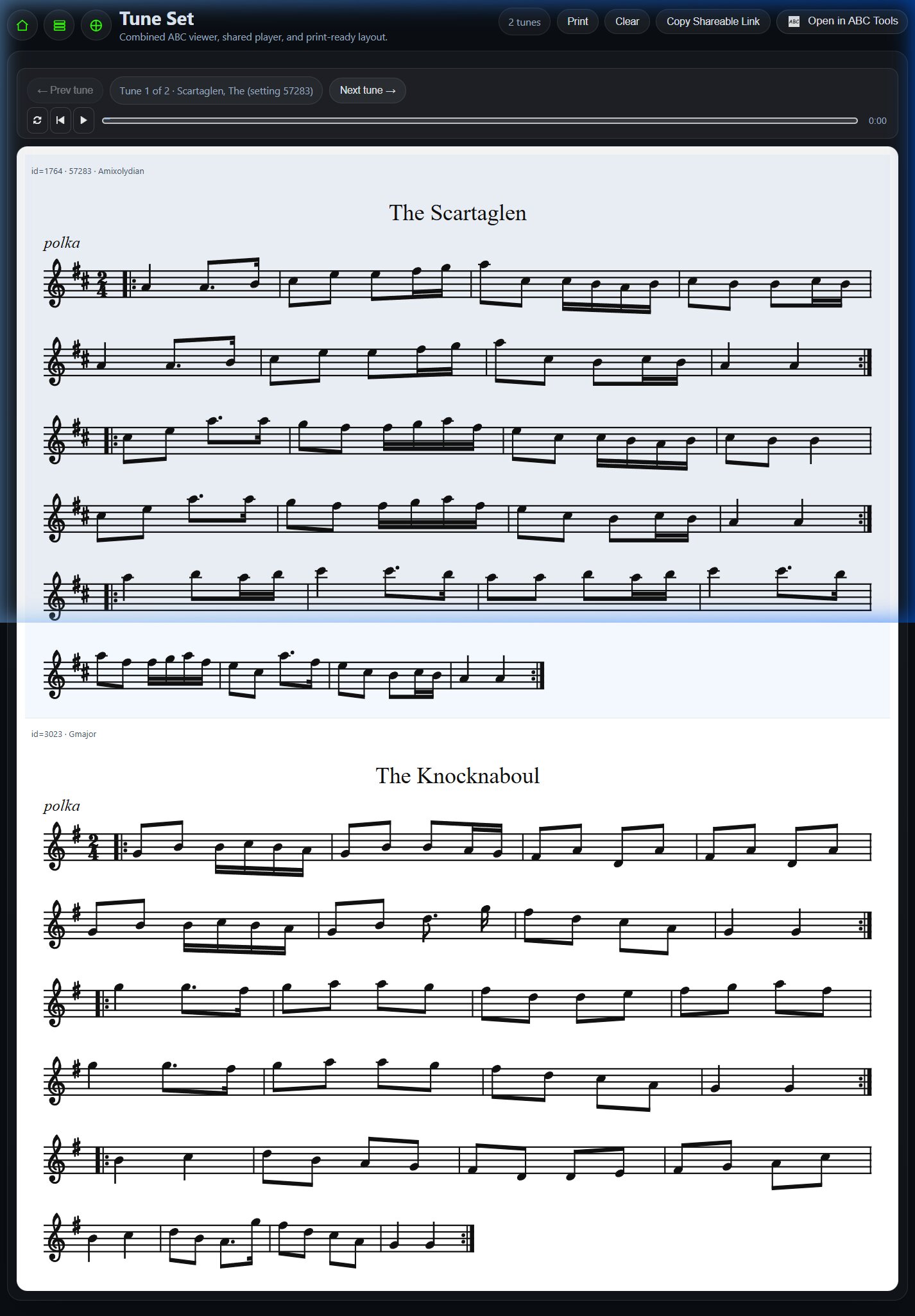 Interactive Setlist Player rendered from mode transition click